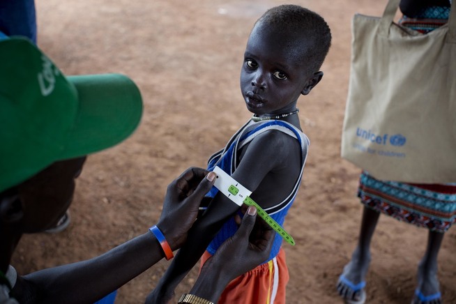 <p>En sørsudansk gutt får målt overarmen for å fastslå om han er underernært. Bildet ble tatt i oktober i fjor. Mandag erklærte ter FN-organisasjoner og landets regjering hungersnød i to av landets fylker. Foto: KATE HOLT / UNICEF VIA AP / NTB SCANPIX</p>