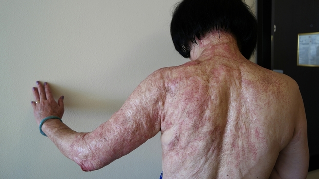 <p>ARR: Jenten på bildet, Kim Phuc, fotografert av Nick Ut (mannen som tok bildet i 1972) i 2015.</p>